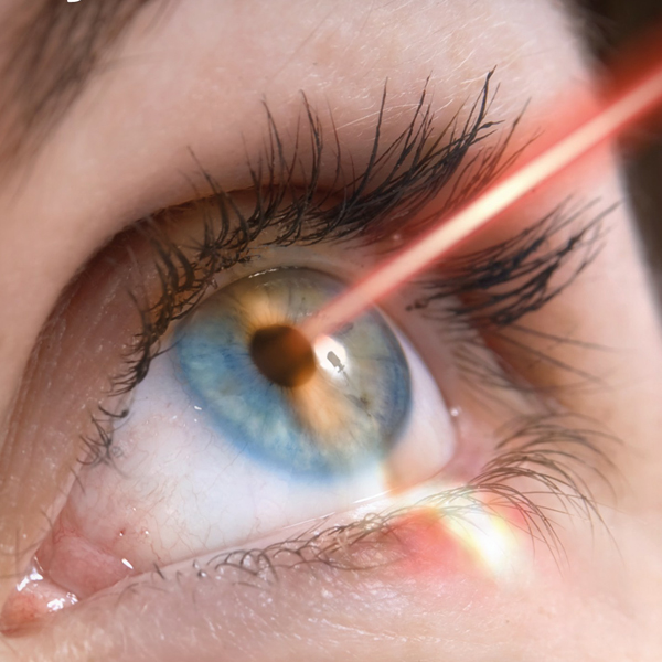 Eye Surgery or Ophthalmology
