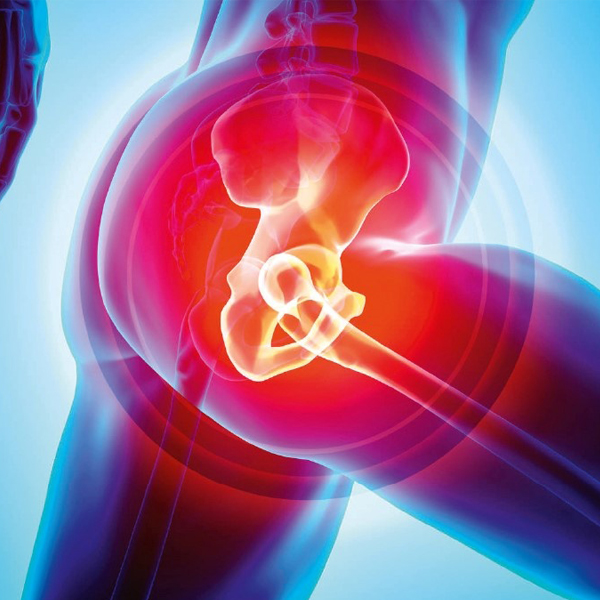 Hip Replacement Surgery