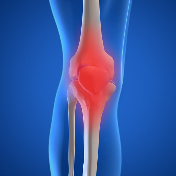 Knee Replacement Surgery