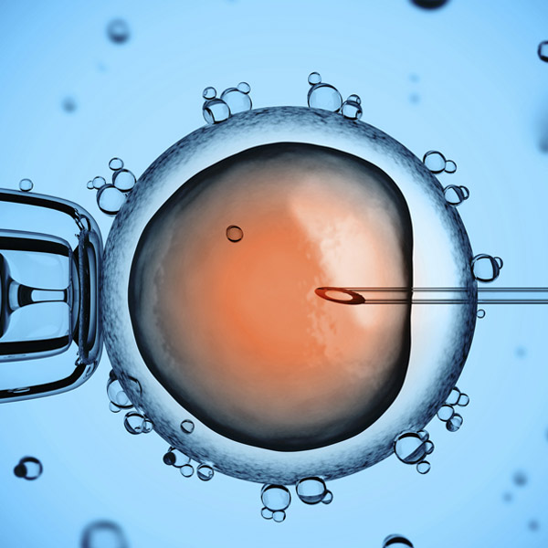 IVF Treatment